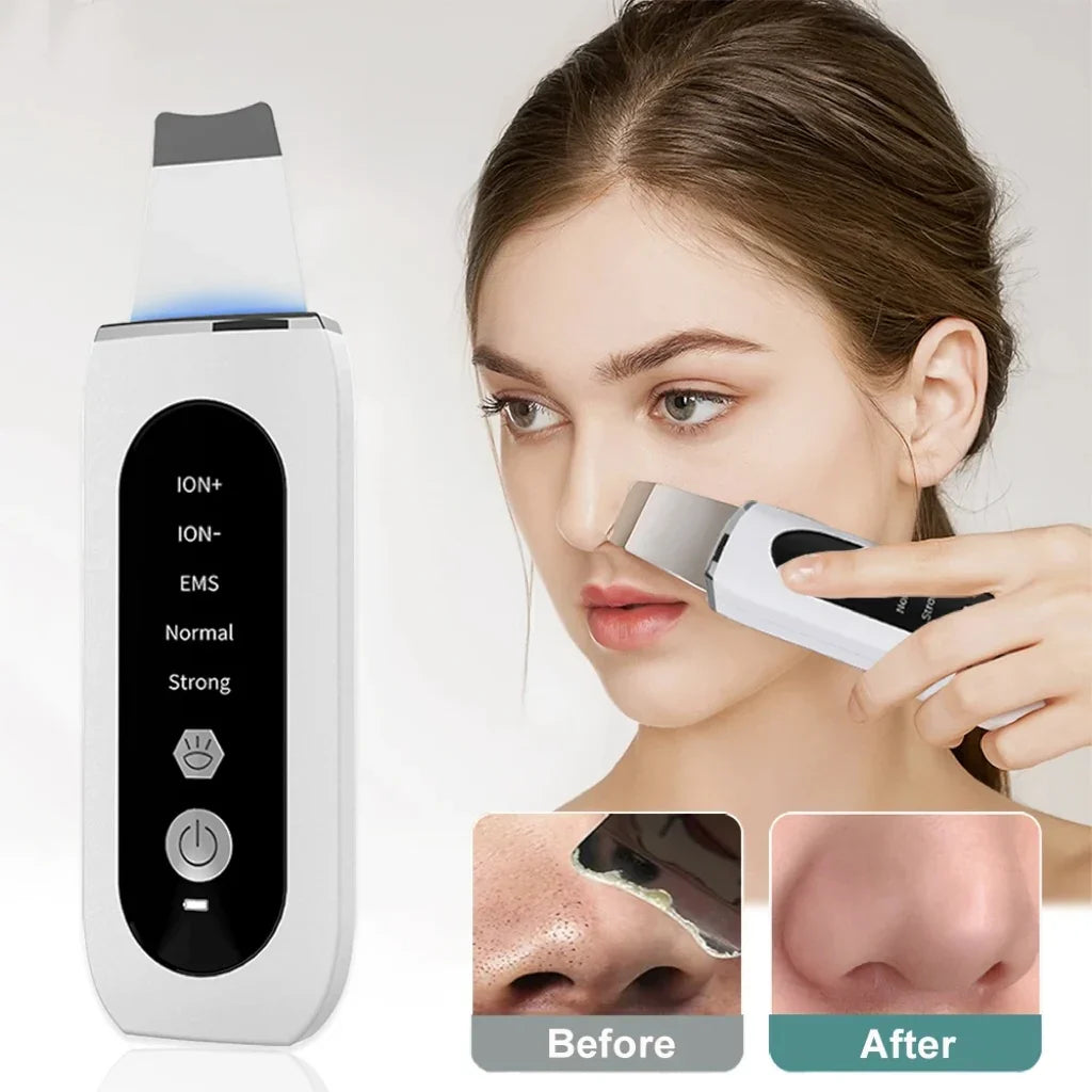 Ultraschall-Hautwäscher-Peeling und Mitesserentferner